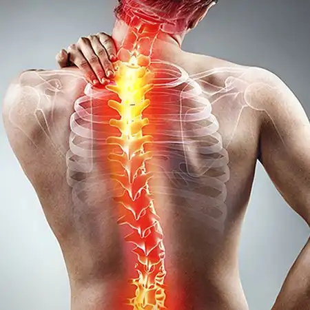 Spinal stenosis and degenerative conditions