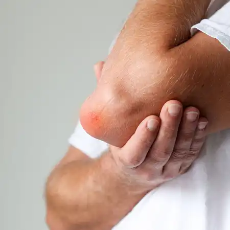 Tendinitis and bursitis
